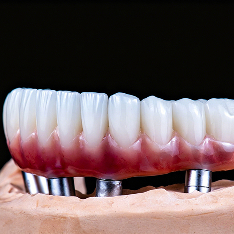 Surgical Grade Titanium Bar